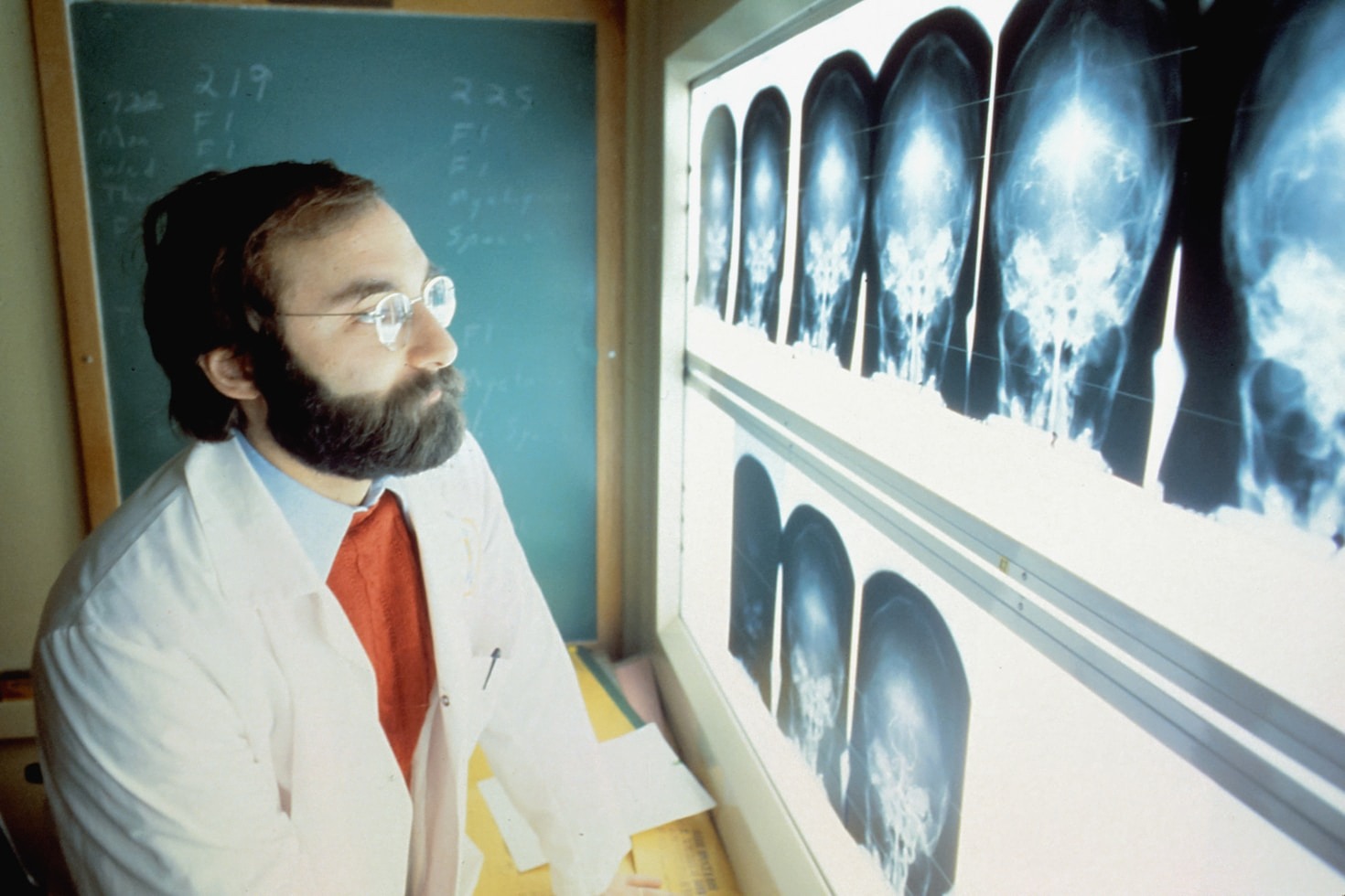 Preventive Strategies for Modern Heart Health